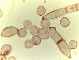 Cladosporium mold spores under the microscope.