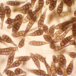 mold inspectors stock photo. Image shows Alternaria spores under the microscope. Commonly recovered by mold inspectors during sampling of the air.