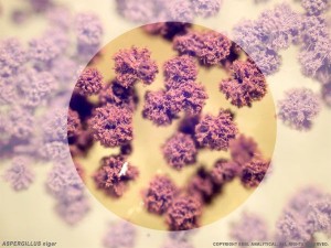Aspergillus niger spores under a microscope. <yoastmark class=