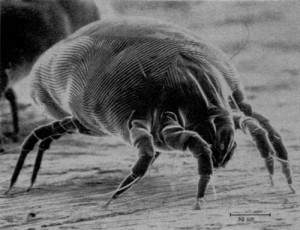 Microscopic image of a dust mite. Dust mites are related to spiders. This one looks like a fat spider under the microscope. They release allergens.