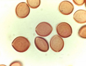 Chaetomium mold spores viewed under a microscope. These spores shape like lemons.