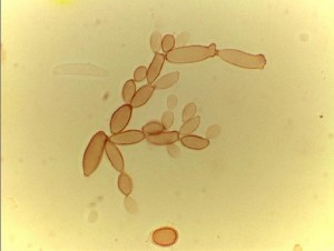 Cladosporium mold spores