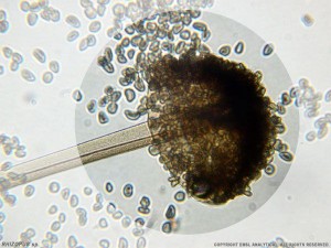 Microscopic photo of Rhizopus mold spores coming off spore producing stalk.