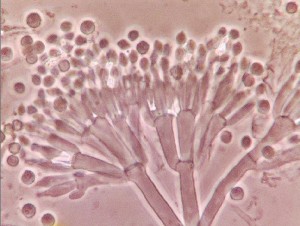 Penicillium spores and conidiophore under the microscope. 