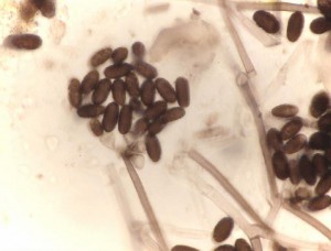 Stachybotrys spores under the microscope.