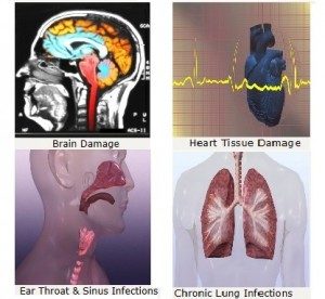 Top left brain, top right heart, bottom left ears, throat, and sinus, bottom right lungs.